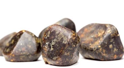 林医师|体内有“胆结石”的人，大多数有以下几个表现，切勿忽视