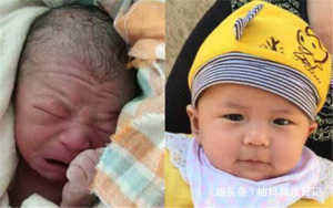 医生|“丑宝宝”被全家人嫌弃,医生却说孩子颜值很高,一个月后奇迹了