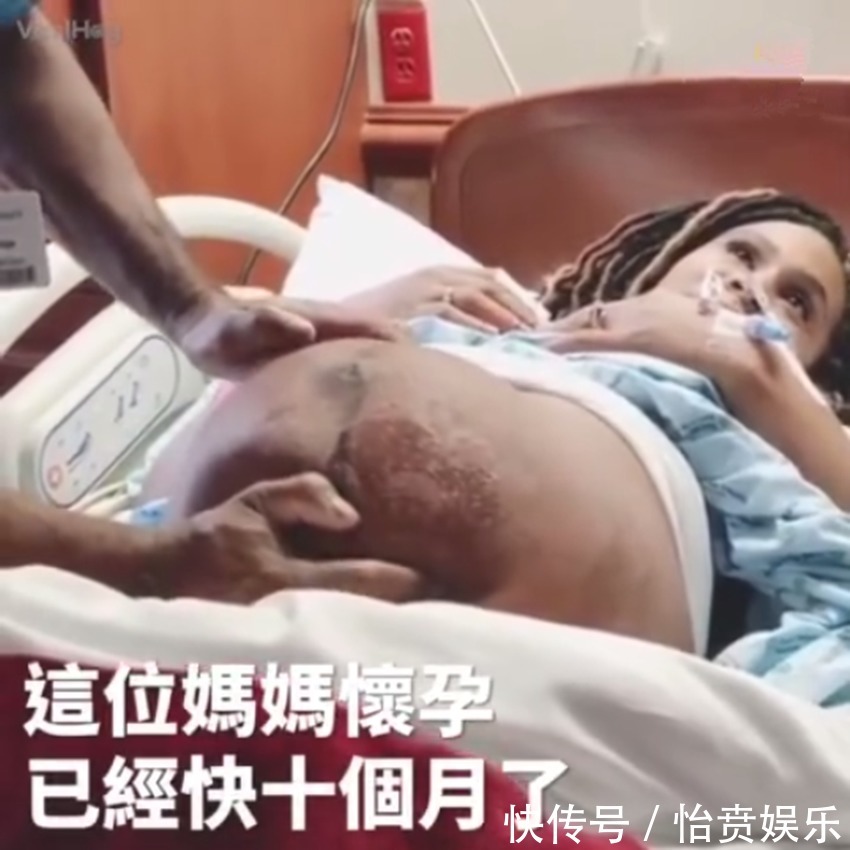 枕前位|医生徒手帮孕妈转胎位，当妈真的不容易，网友这肚皮都薄成纸了