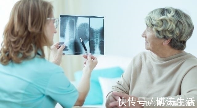 3物|女人“贪嘴”3物,子宫肌瘤可能越“兴奋”,要及早忌口