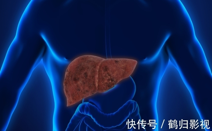 食用|80岁肝科医生呼吁停止食用，比方便面还伤肝脏，或致肝硬化