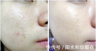 长期|长期素颜和长期化妆,皮肤有何不同?看后就知道了!