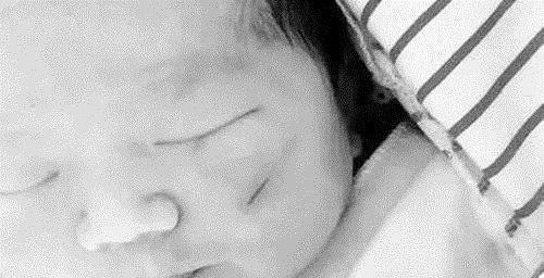 分娩|宝宝头部被剖腹产划伤,凭啥不算“事故”院方的回应很有道理