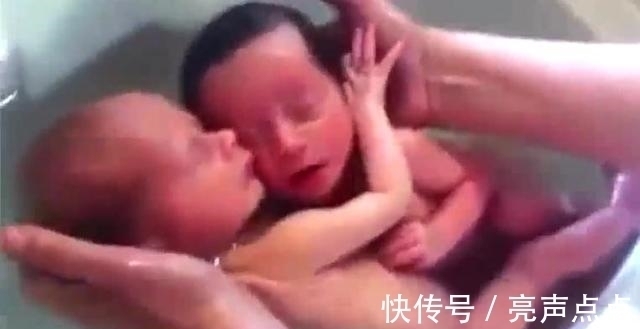 小家伙|双胞胎哥俩被剖腹抱出,哥哥以为有危险,一把将弟弟搂住!