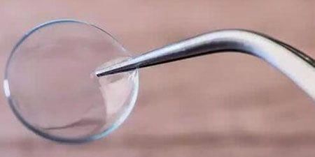 路易斯|女子眼睛不舒服,手术取出27枚隐形镜片,直称“无感觉”