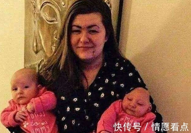 切除|刚来世的女婴切除大脑,医生放弃治疗,但妈妈的话却救了她一命