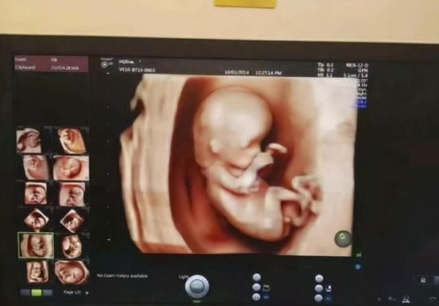 孕晚期|孕期进入第28周，准妈妈要做到“3小心”，对自己和胎宝都有利