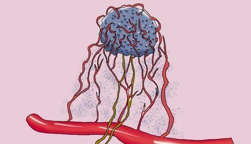 癌细胞|为何有的癌症患者一年就复发，有人却20年才复发？