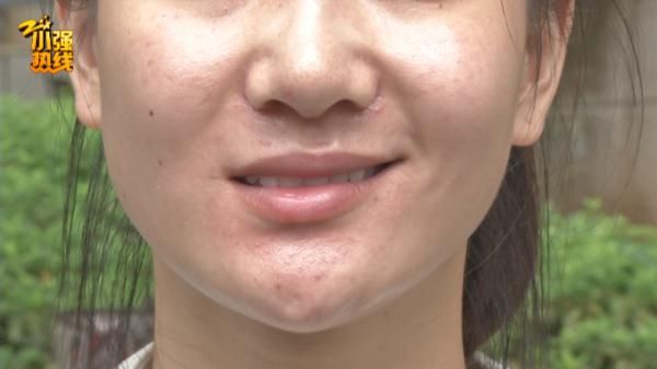 余杭区|23岁女子做医美，脸上发生奇怪变化，更不可思议的是…