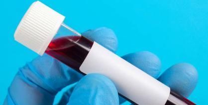 痛风|45岁男子一检查就发现痛风,是怎么回事?原来是因为此生活习惯