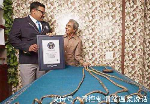 手指|印度老人将留了66年的指甲剪下,封存博物馆后,手指却产生新变化