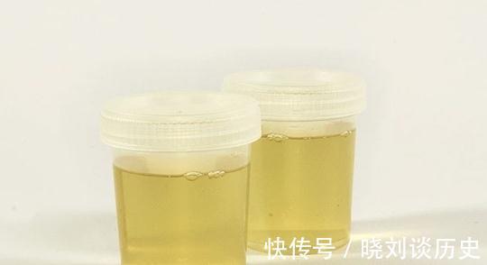 临床表现|起夜频繁是小事?高血压患者要小心!