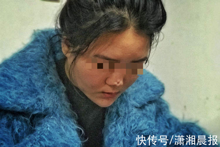 癜痕|女子听信“闺蜜”隆鼻惨遭破相，鼻尖留下深坑专家称修复可能性很小