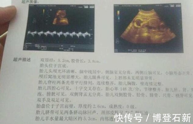 顺产|产妇自述“胎儿太调皮,宝妈‘顺转剖’6斤小胖妞”