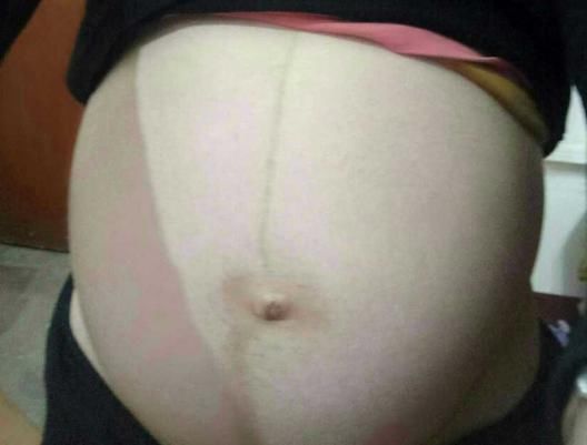 胎停育|怀孕晚期被诊断胎停育,医生怒斥太可惜太无知