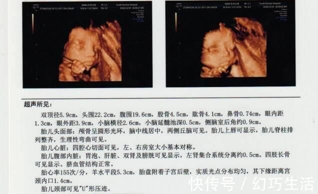 检查|孕期四维彩超，能看懂检查报告的这三点，胎儿或许就没有小秘密了