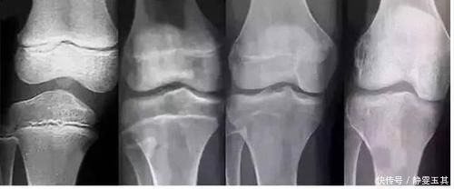 脾胃|10个孩子8个“早熟”,别再怪豆浆奶粉,“元凶”就在家里