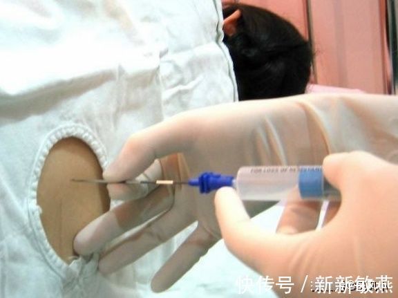 12c|剖腹产最疼的5个时候,看完深感女人不易!你还忍心对她不好吗?