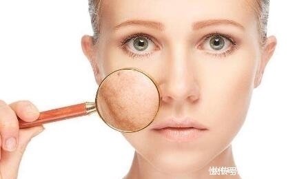 皮肤|皮肤受伤,这几个举动会让你留下疤痕,再不注意就会“中招”了