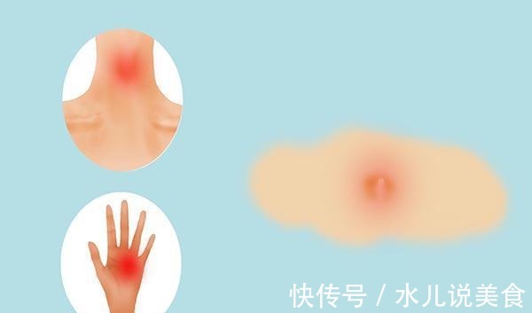 表皮|体内有癌,皮肤会打“小报告”,若没有4个异常,或可安心