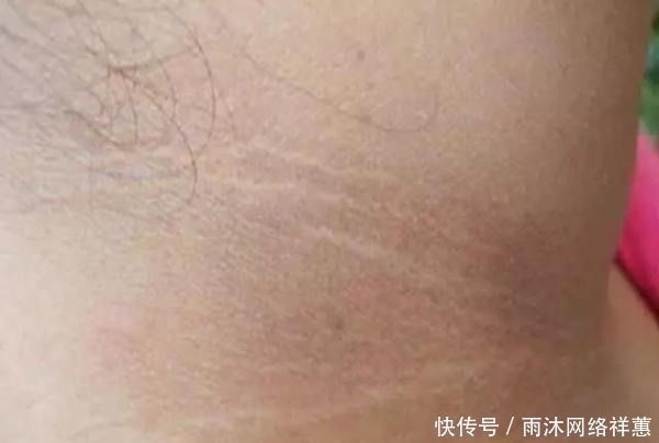 医生|十岁小男孩脖子一圈发黑洗不掉,听了医生的话后,家长们都笑了