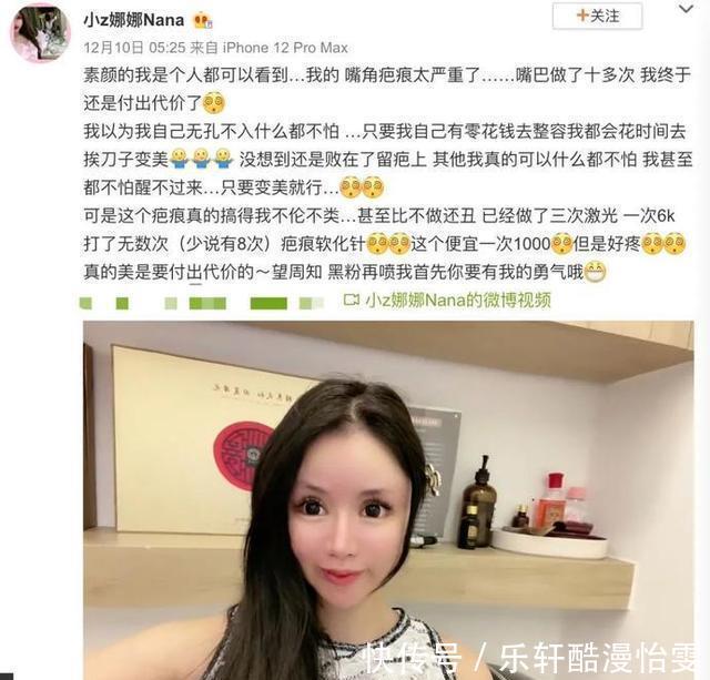 娜娜|被整容毁掉的女孩“我的整形医生,只给鸡腿做过手术”