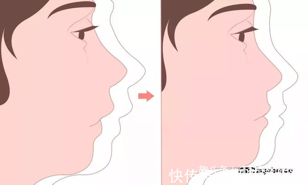 口腔|儿童这些不良习惯，是导致牙齿不齐的原因所在！