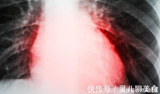 心脏|胸痛竟与心脏没多大关系医生胸痛大部分是由这4种原因造成