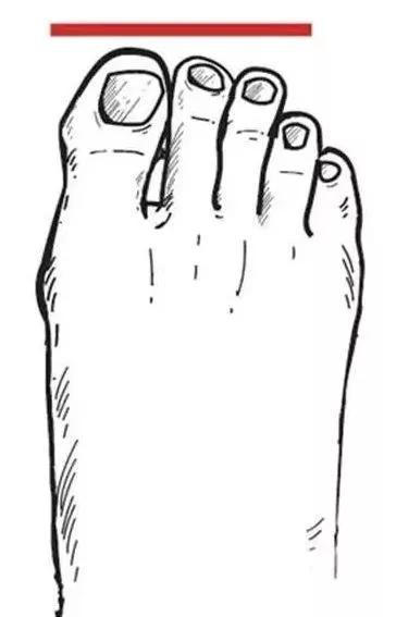 前端 你的脚型穿对了鞋吗希腊脚是公认的美女脚,很多人是埃及脚