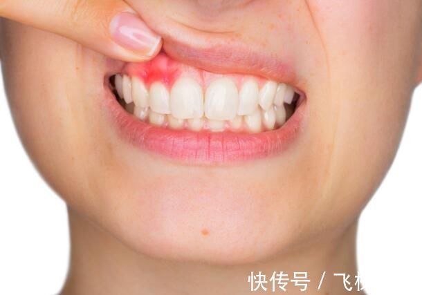 消化道出血|以下几个症状可能是癌发出的信号，如果你能抓住，或许就能活命