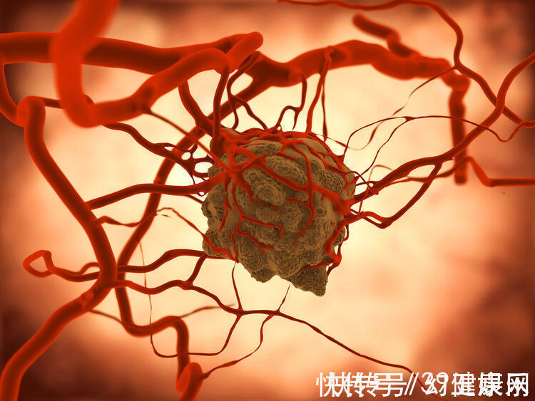 化疗|七旬肿瘤专家患癌,每月化疗8次,临终前遗言:没想到癌症这么痛