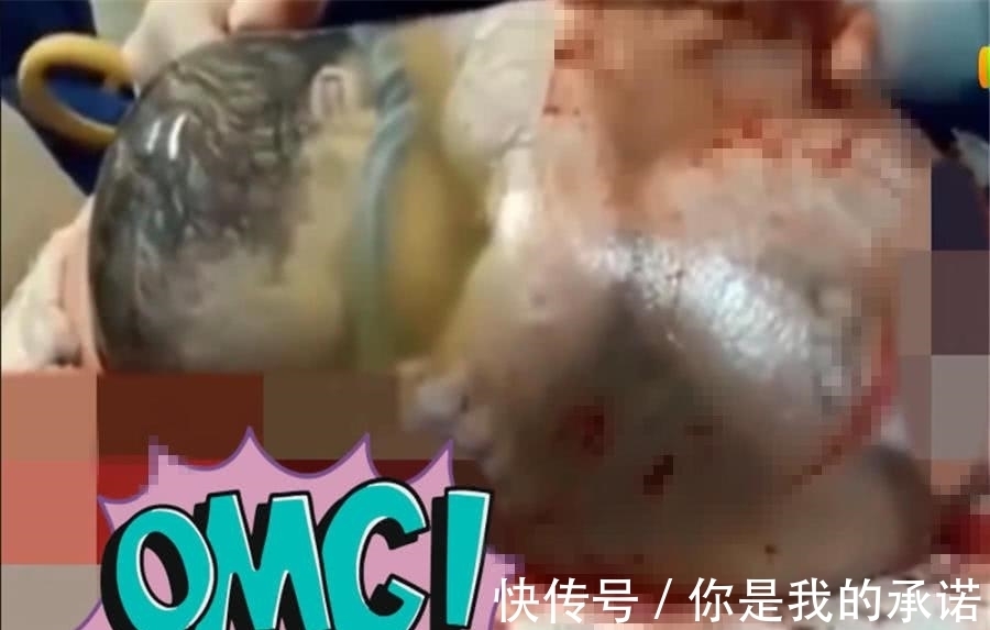 宝宝|婴儿出世羊膜完好无损，蜷缩身体再现子宫内情况，医生：概率极低