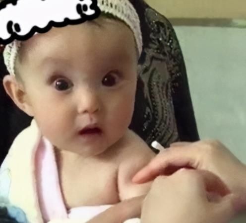 医生|8个月大宝宝接种疫苗,表情太丰富医生不忍心,网友:奥斯卡影帝