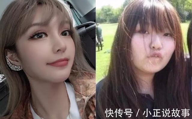 医生 女子整容失败，说好的明星同款鼻子，术后直言笑都很困难！