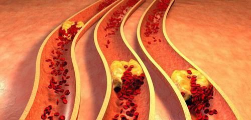 血液|一旦发现血脂高，6种食物要多吃，帮你净化血液， 血脂自然消