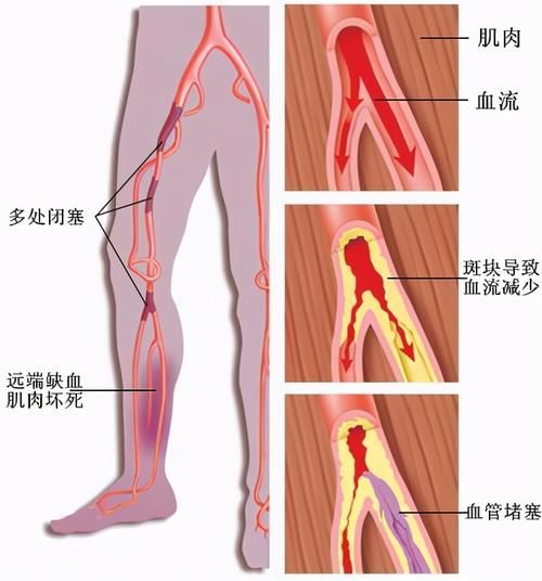 睡前热水泡脚对身体有好处吗？医生说请看此文