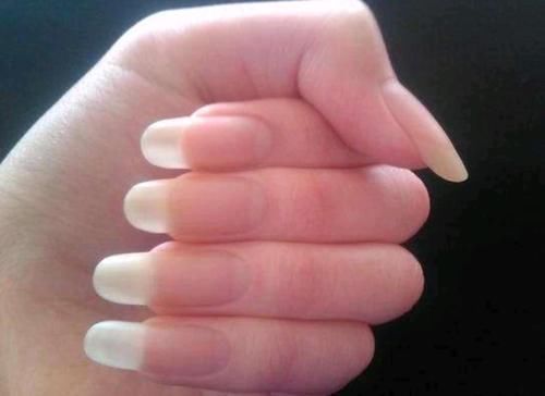 毛细血管|人闲下来是不是容易长指甲,心宽的人是不是容易长头发?