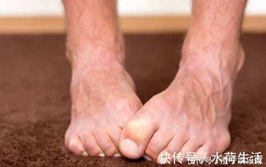 红酒|血管堵塞时，脚上或许会发出信号，若都没有，说明血栓离你还很远