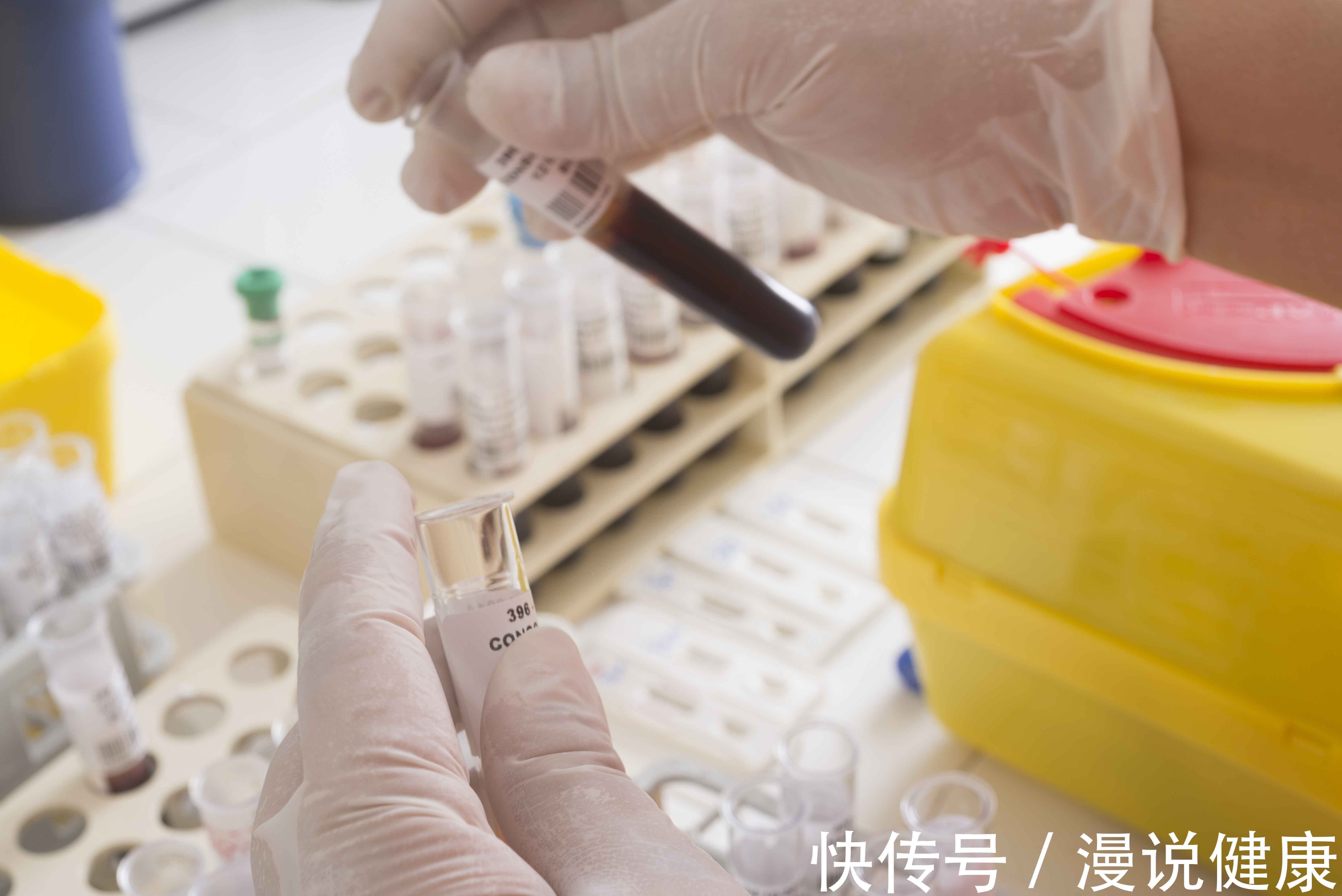 埃斯佩兰萨|全球已出现第二例艾滋病自愈者:面对艾滋病,真的有望能够自愈?