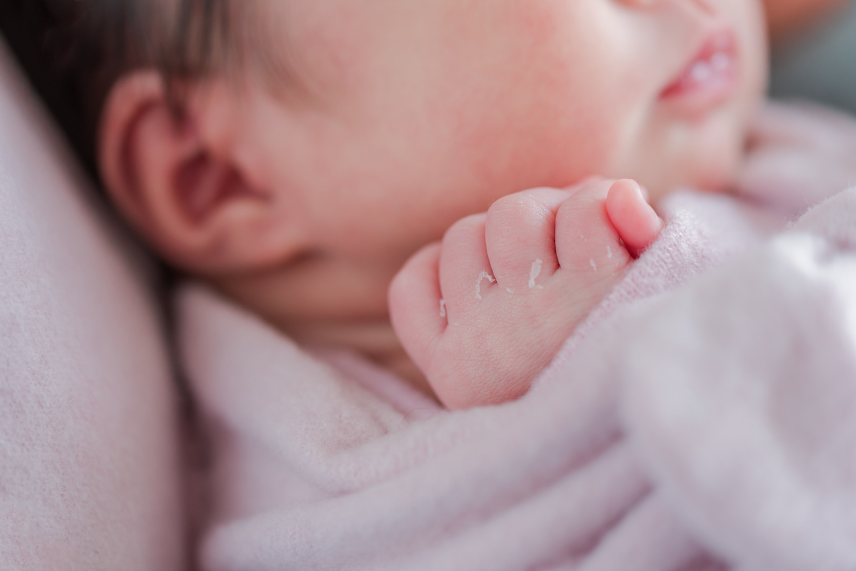 胎粪|新生儿有这6种异常不是病,别乱治疗