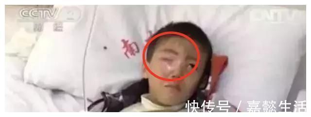 男孩|仅20分钟，男孩眼睛被“熔化”，这东西家家都有，父母们别大意