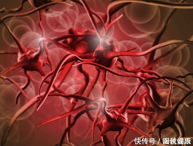 中年后,不想血栓找上身,做好这3件事,能够预防血栓