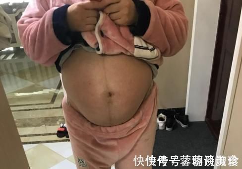 瓦尼|好丑?产检单上的胎儿,和实际胎儿有哪些差异?