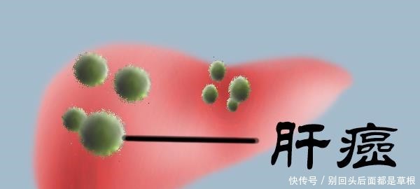 延长|肝癌从早期到晚期，可能经历多长时间做好几件事或能延长生存期！