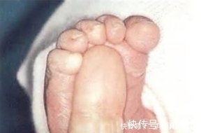 足跖|一周岁前做好两件事，孩子就不会语言迟缓，保证口齿伶俐