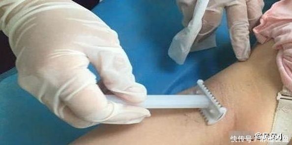 考验|从产前到产后，女人可能要经历多少种考验？由衷感慨母爱伟大