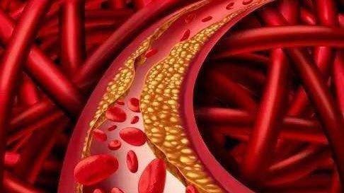 三位院士声明开水里加一勺,连喝15天,血管通透明亮,血脂悄悄