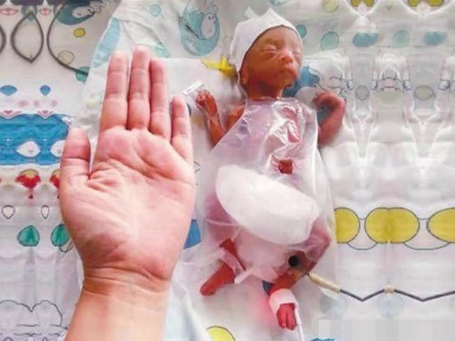 打麻将|90后孕妈天天打麻将，结果孩子生下来，接生大夫看了转身就走