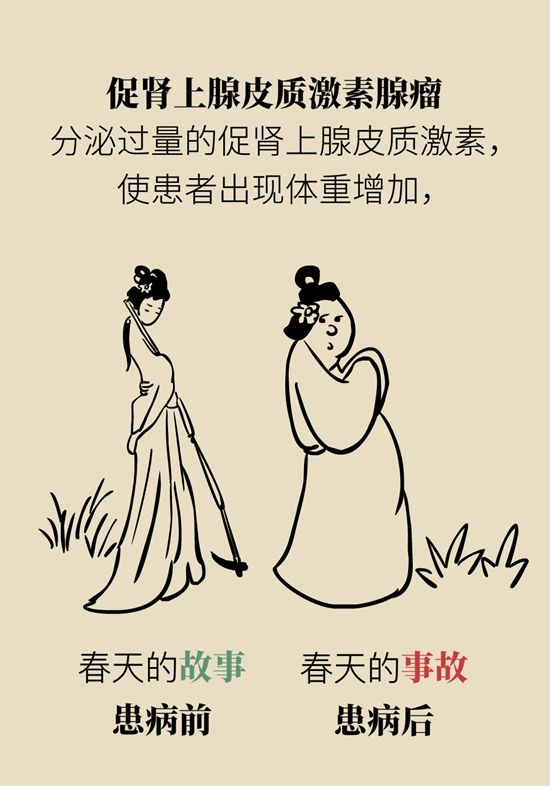 内分泌失调|变丑、变胖、内分泌失调……这些糟心事警惕脑肿瘤