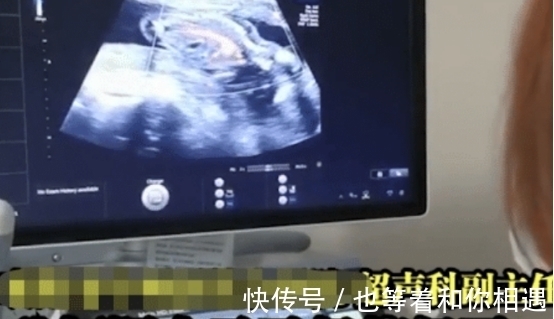 女子|40多岁女子肚子胀气去检查,医生:你怀孕了,孩子脚都出来了